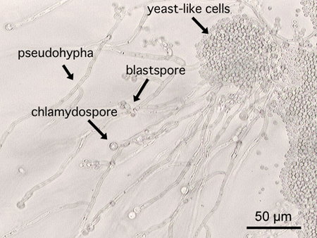 pseudohypha