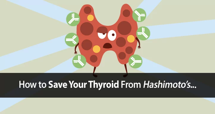 hashimoto's thyroiditis