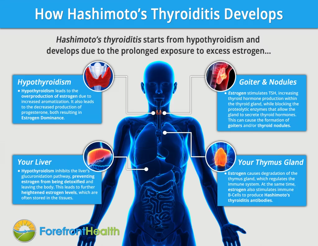 new research hashimoto's thyroiditis