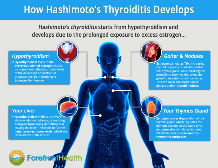 howhashimotosthyroiditisdevelops