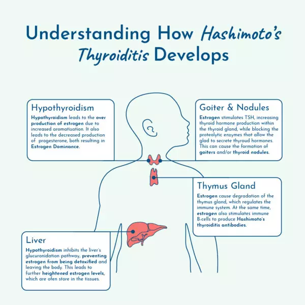 Hashimoto’s thyroiditis development explanation