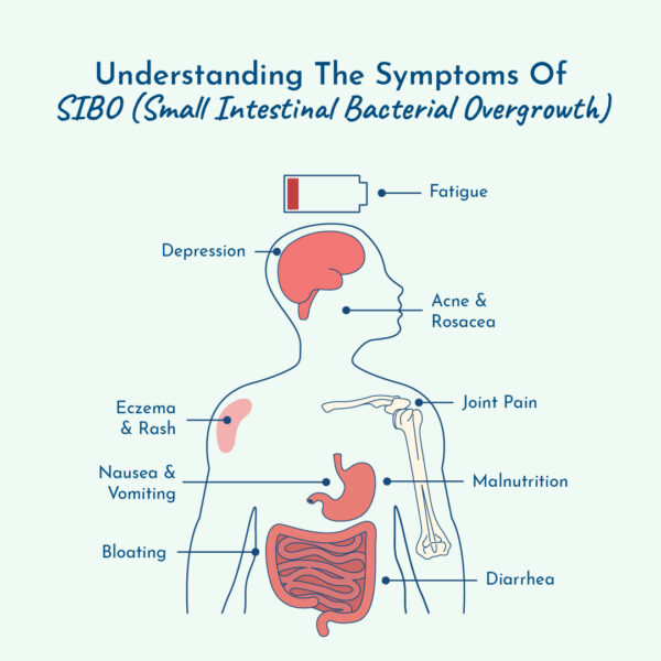 Graphic showing the symptoms of SIBO