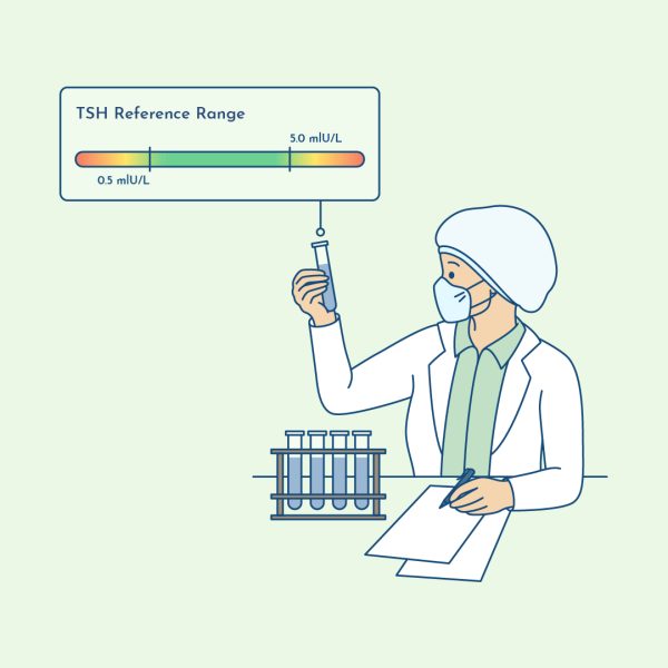 TSH reference range