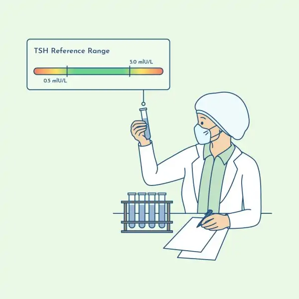 TSH reference range